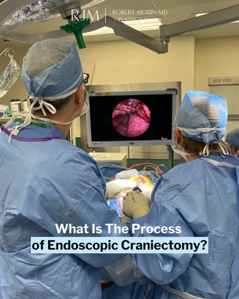 Endoscopic Craniectomy